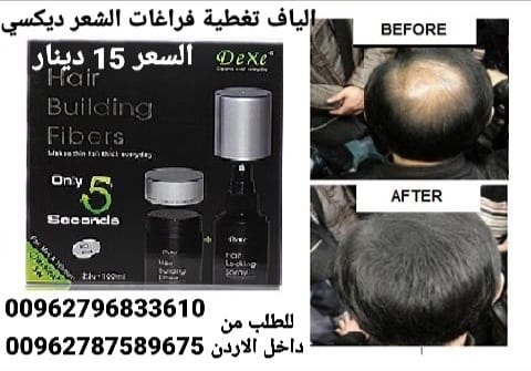 الياف بناء تغطية فراغات الشعر ديكسي عند الرجال والنساء