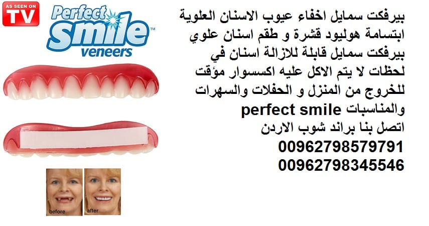 تركيب اسنان علوية بيرفكت سمايل اسنان اكسسوار : perfect smile اعمل تجميل لاسنانك بطريقة احترافية تركيب وتجميل لاسنانك فقط خلال 30 ثانية