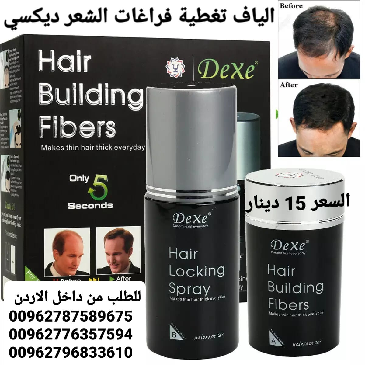 الياف شعر للرجال تغطية فراغات الشعر الخفيف والصلع ديكسي عند الرجال والنساء