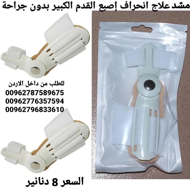 جهاز علاج انحراف إصبع القدم الكبير بدون جراحة